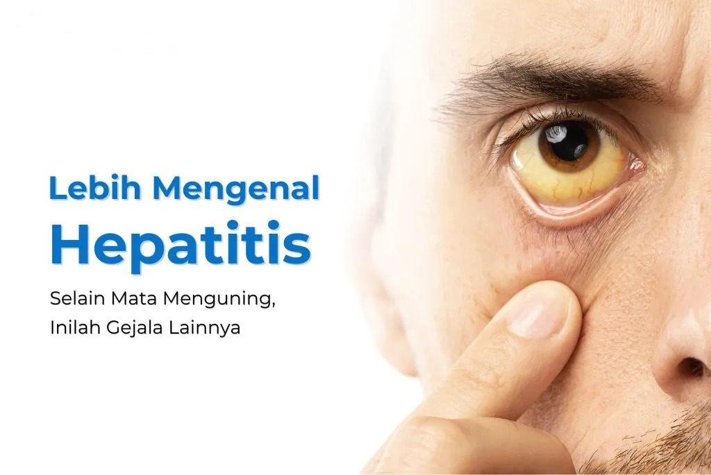 Mengenal Obat Hepatitis: Jenis, Cara Kerja, dan Aturan Pakainya